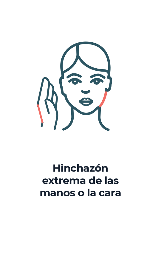 SwellingFaceHands SPA